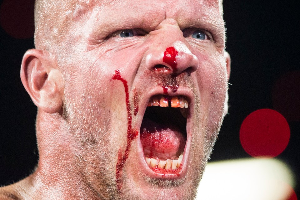  Fighter Lee McGarry is bloodied after winning his bout at the event