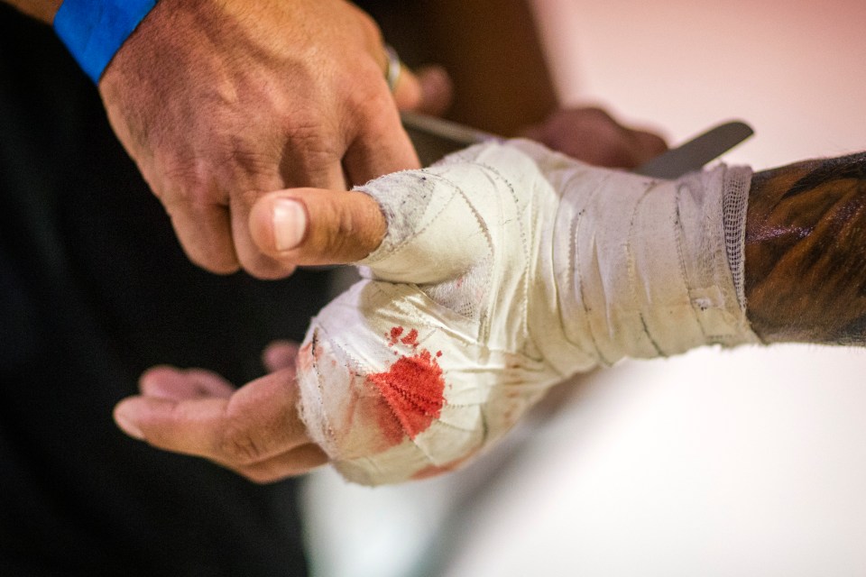  Fighters have their hands bandaged