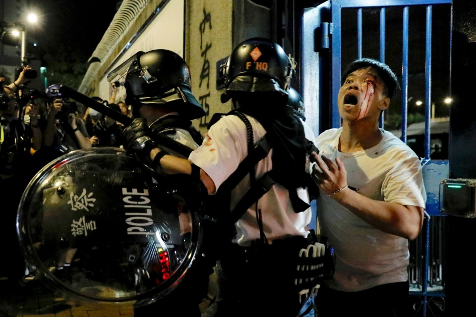  A bleeding man is taken away by policemen after being attacked