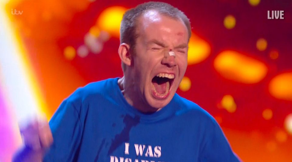  Lee was thrilled to win BGT in 2018