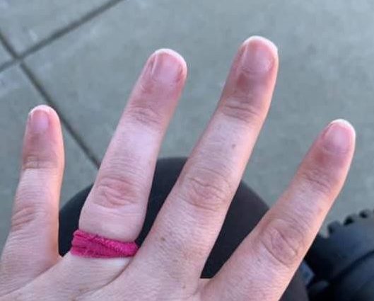  A woman who used a hair tie as a "temporary" engagement ring has been mocked online