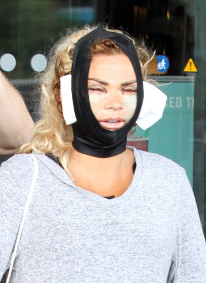  Katie Price looked bruised and battered after her second face lift in Turkey