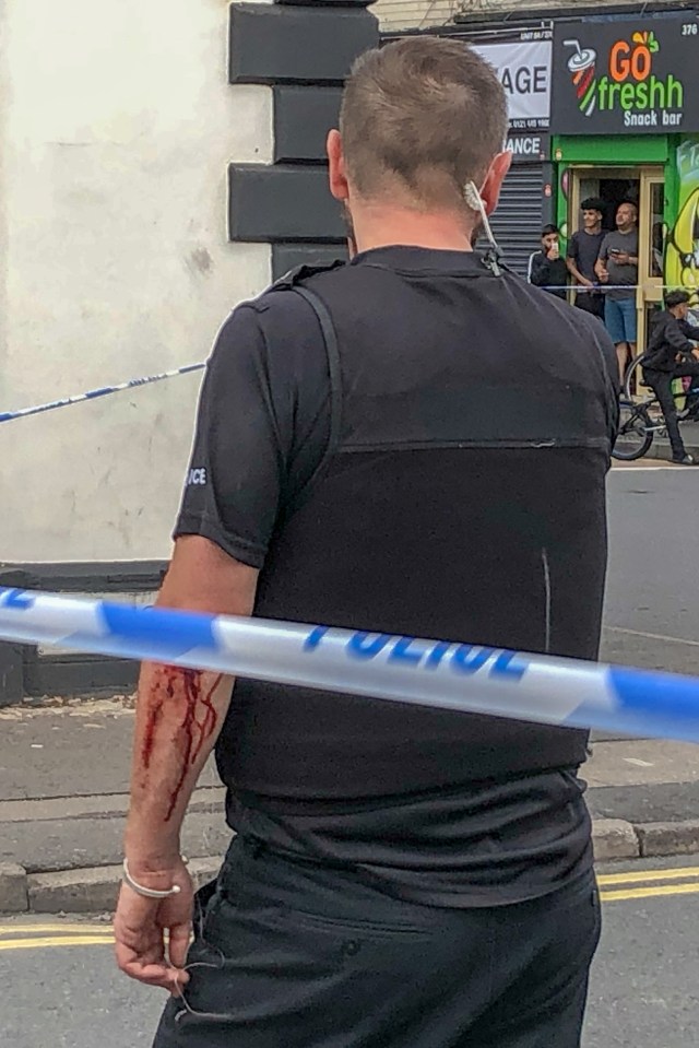  A police officer is seen with blood dripping down his arm after the attack