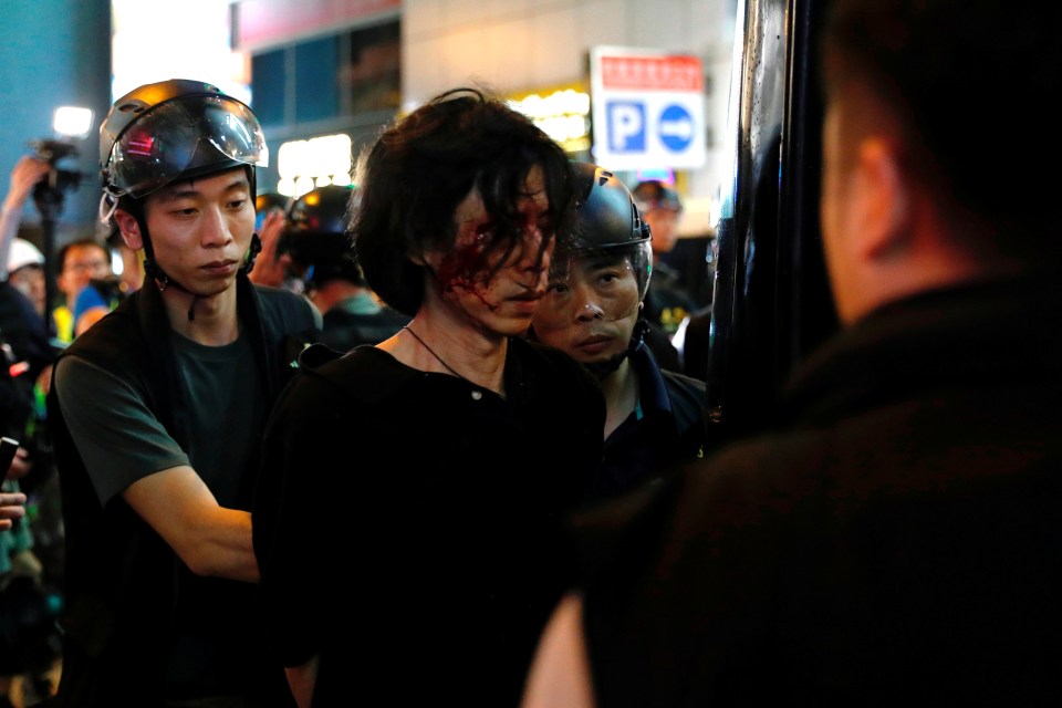  A protester gets arrested as he bleeds from his forehead