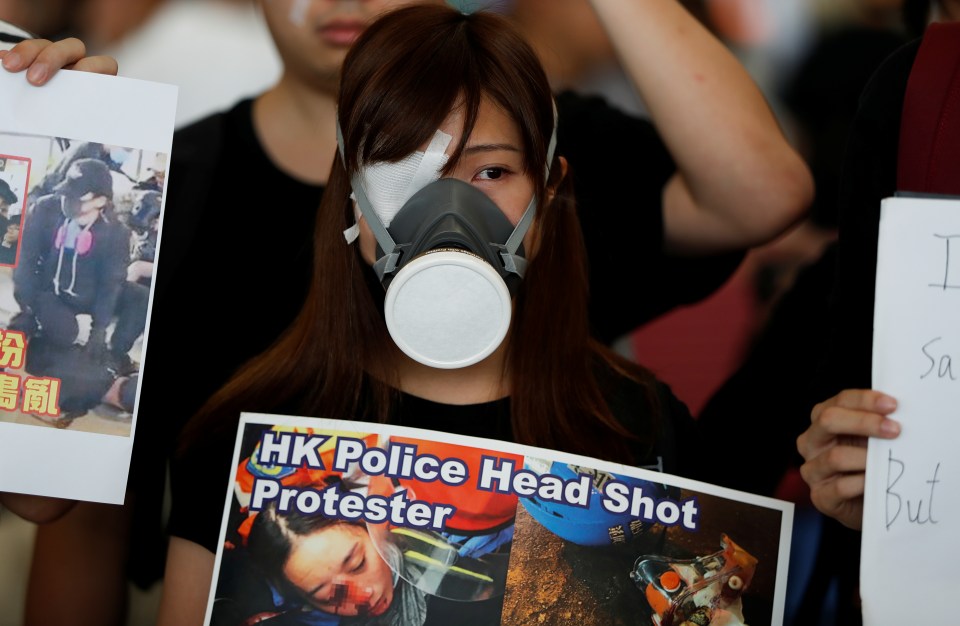  Demonstrators covered their right eye in solidarity with a woman who was shot by police