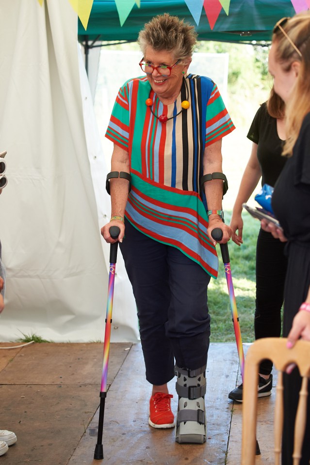  Bake Off's Prue Leith was left on crutches after a freak accident during a Wizard of Oz skit