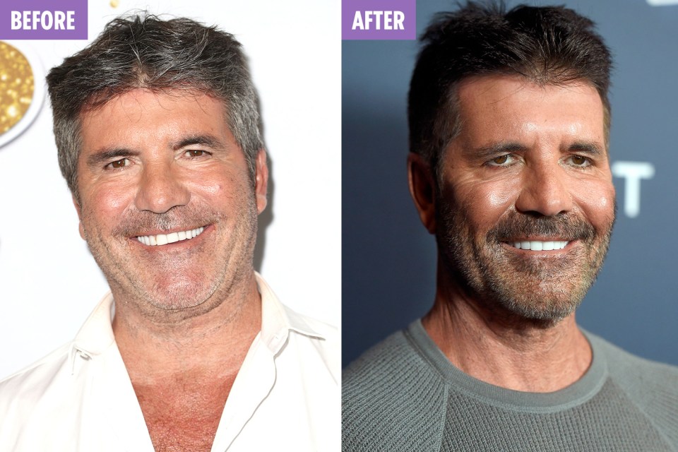  Simon Cowell looks strikingly different in pics taken exactly one year apart