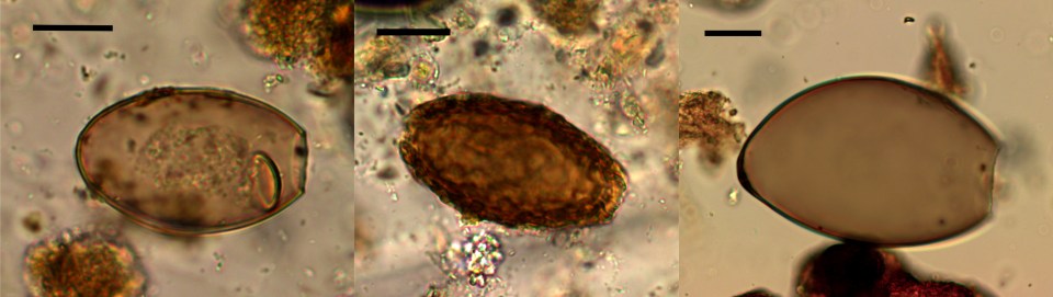  This image shows the microscopic eggs of fish tapeworm (left), giant kidney worm (centre) and Echinostoma worm (right) from the excavation