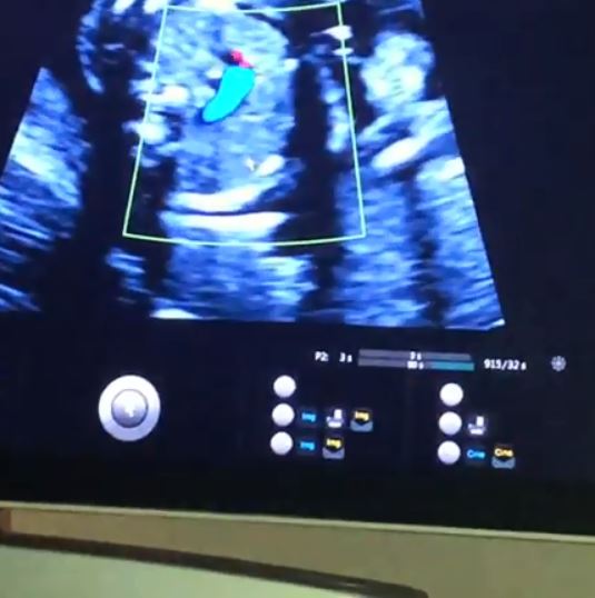  Rebekah Vardy shared an adorable clip from her latest baby scan on Instagram today