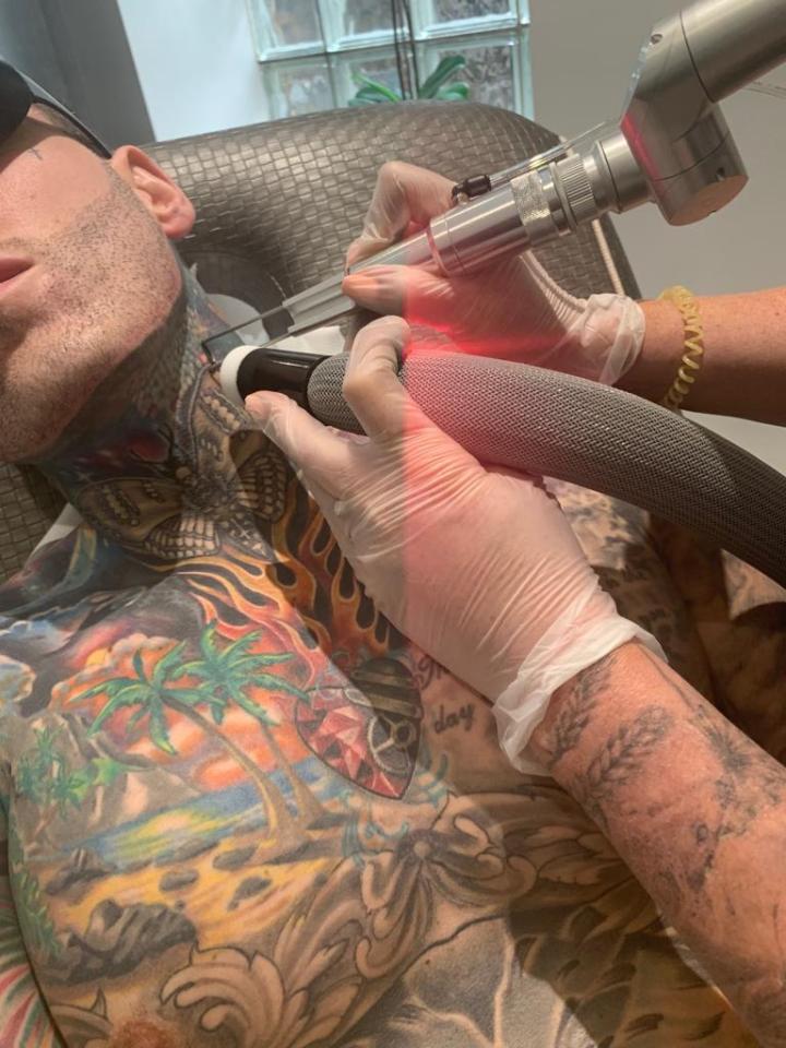  Jeremy McConnell is having his neck tattoos lasered off