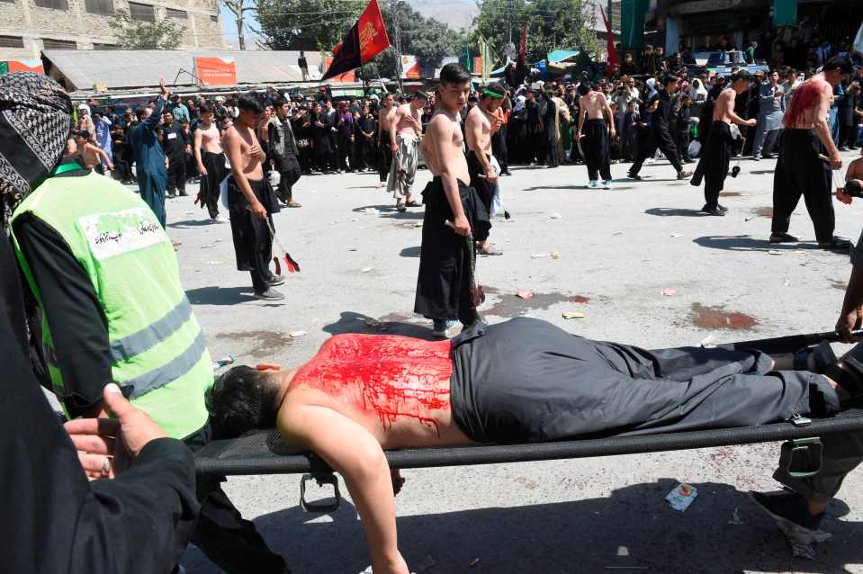  Volunteers in Pakistan take a mourner for treatment after he has self-flagellated