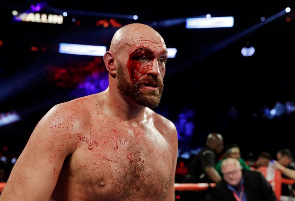 Fury was left with blood pouring down his face after having his eye cut