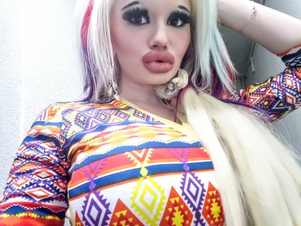 Andrea Ivanova, 22, has undergone 15 plastic surgeries and says she wants the biggest lips in the world