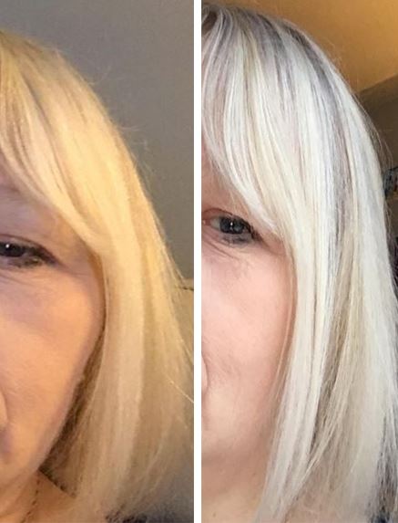  This woman also shared her before and after shots