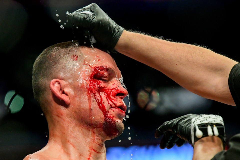  Nate Diaz was told by doctors his eye was too badly busted up to continue