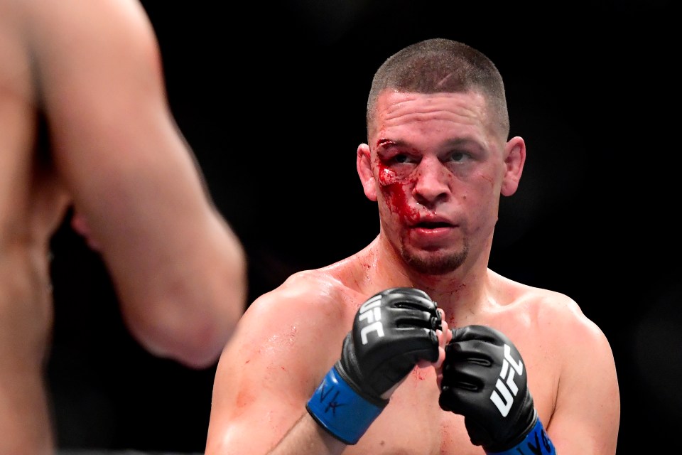  Diaz was badly cut and swollen above his right eye during the fight