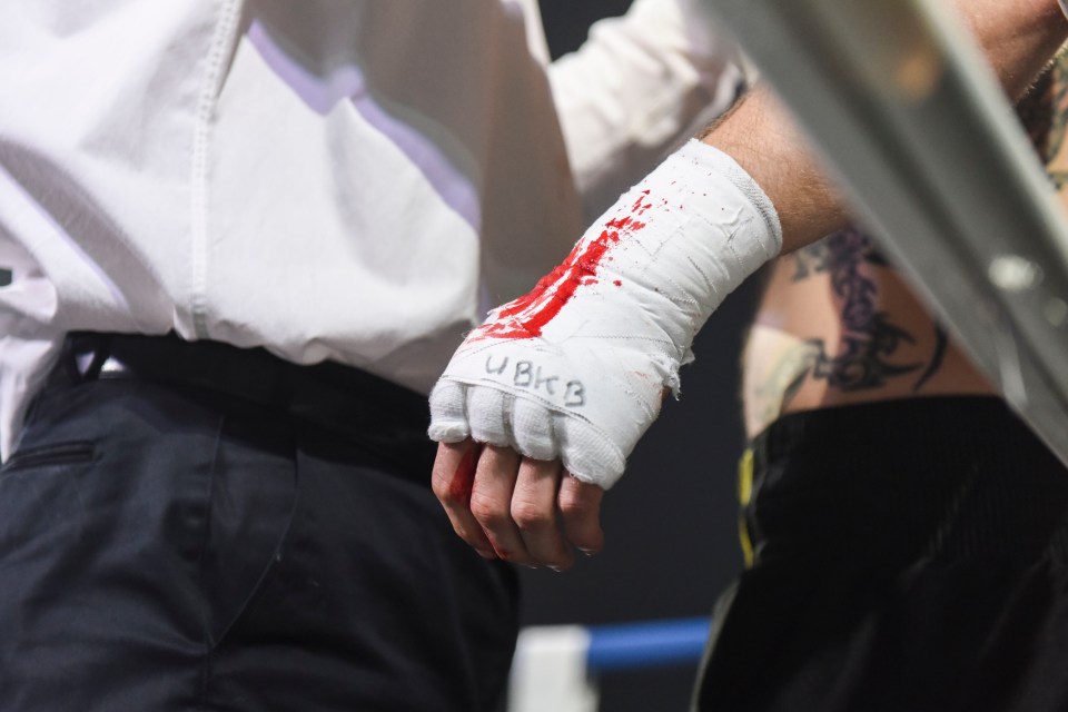  Without the padding of gloves the sport is bloodier than conventional boxing