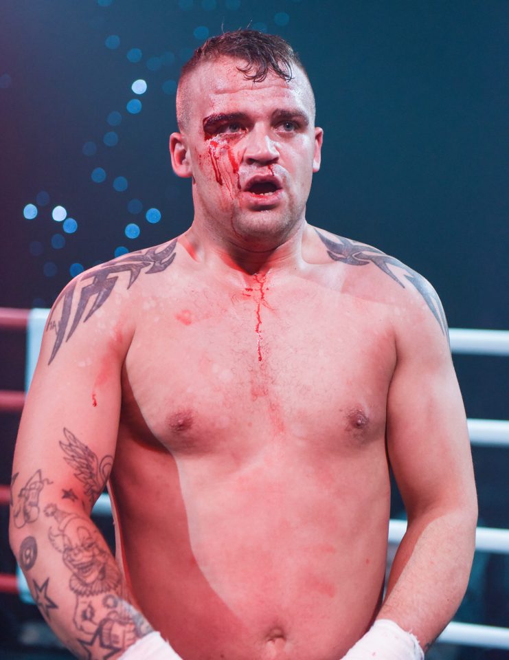  Brad Harris was left bruised and blooded after his bout with Tom Briggs