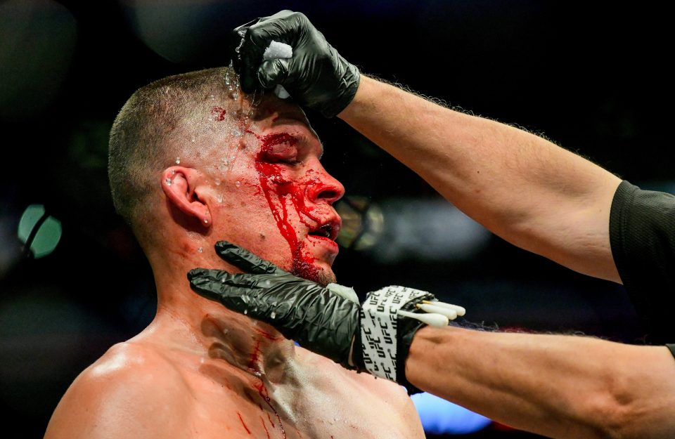  Nate Diaz received a 90-day medical suspension after suffering two gruesome cuts in his loss to Jorge Masvidal