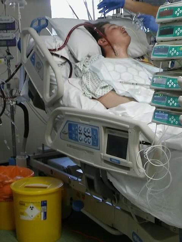  Ewan's condition went rapidly downhill, and he ended up on life support