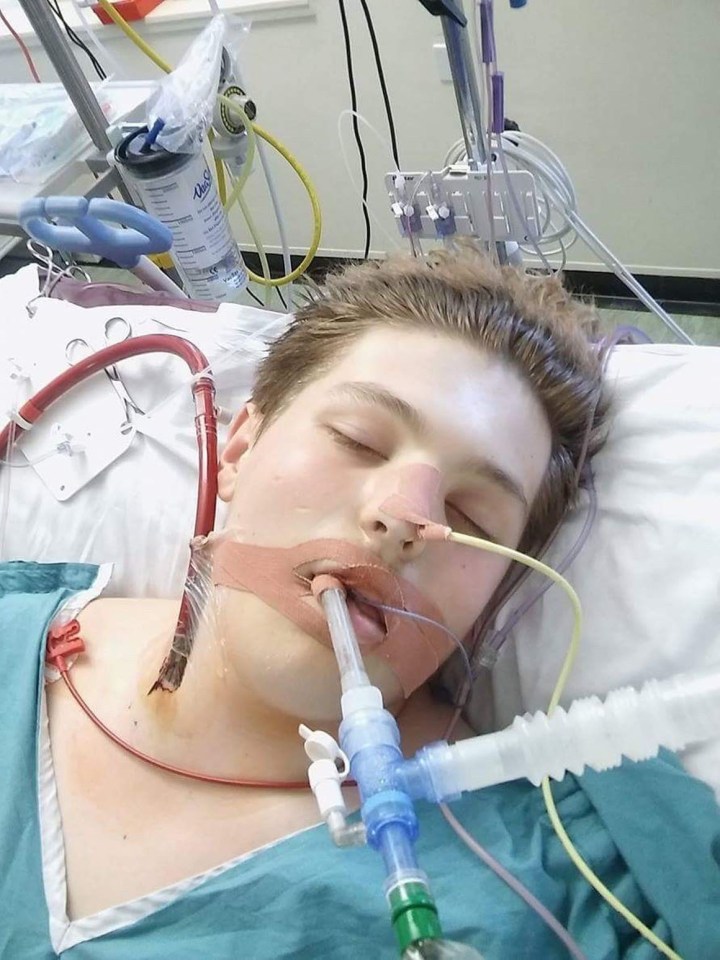  Ewan Fisher, 16, suffered 'catastrophic' respiratory failure after taking up e-cigs