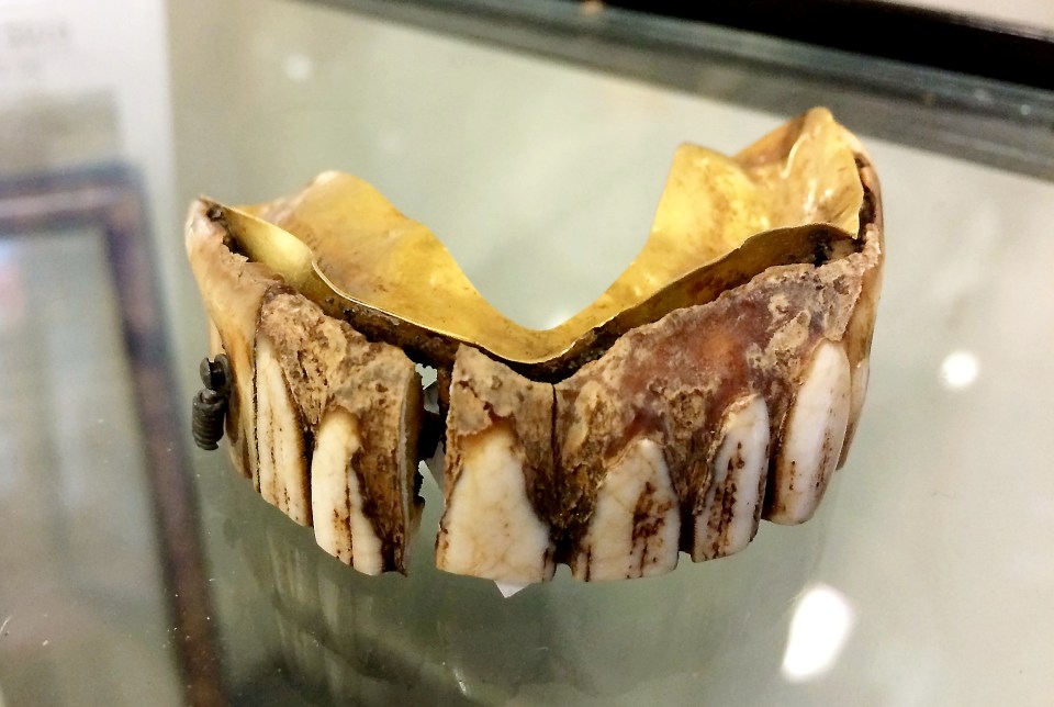  The dentures are hundreds of years old and likely belonged to a very rich person