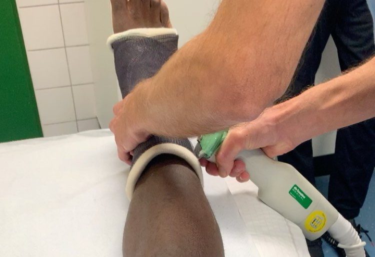  The cast encasing the midfielder's ankle has been removed