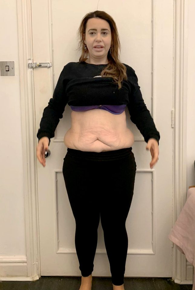  Victoria lost 11 stone after printing off a photo of herself at her heaviest and sticking it to the door of her fridge