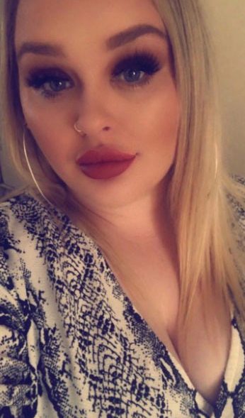  Tamzin Evers says the lip filler clinic organiser vanished with her cash