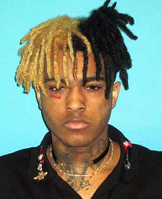  XXXTentacion was shot in an armed robbery