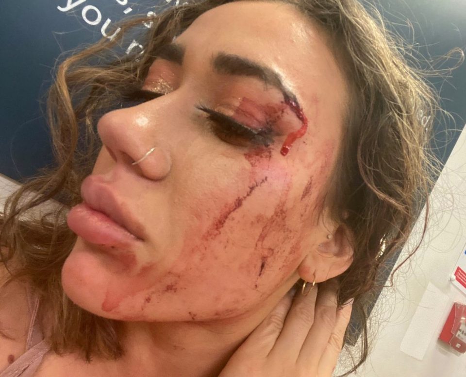  Natasha Tourmentin was left with a bloodied face after the incident