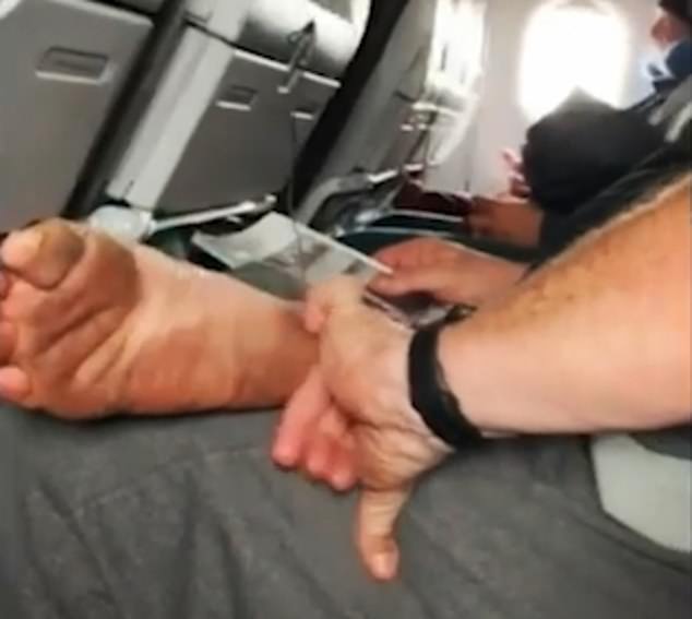  A male passenger was filmed picking at his feet on a flight