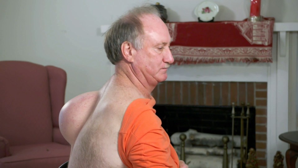  Farmer Tim revealed he’s had the lump on his back for at least 10 years