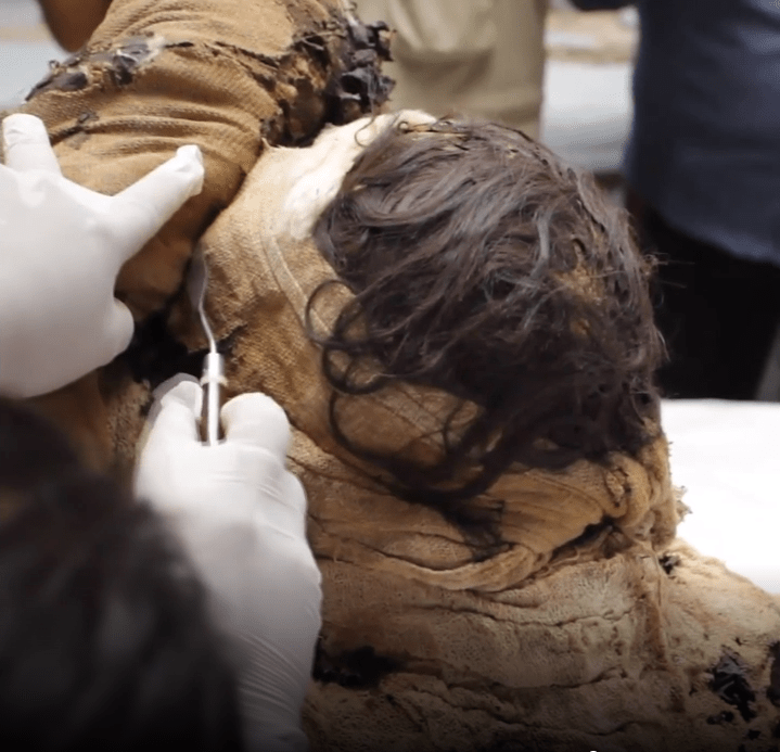  Hair on the mummy can be seen here