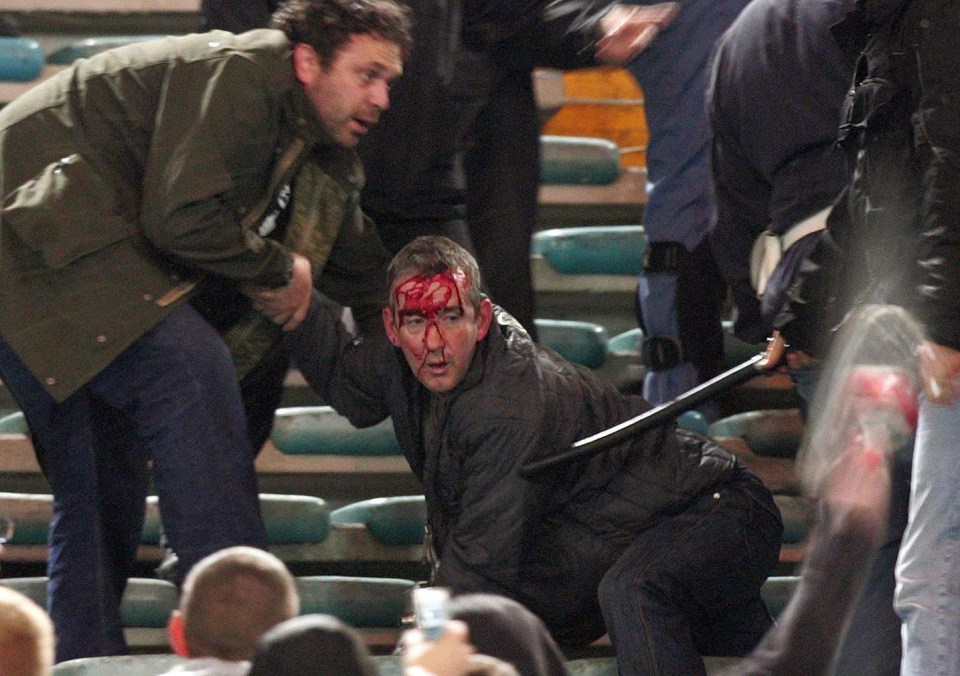 A bloodied Manchester United fan in Rome in 2007 – fighting broke out in the stands between supporters and the police