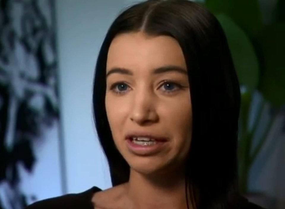  Australian Mikayla Stutchbery was nearly blinded after filler was injected into her arteries