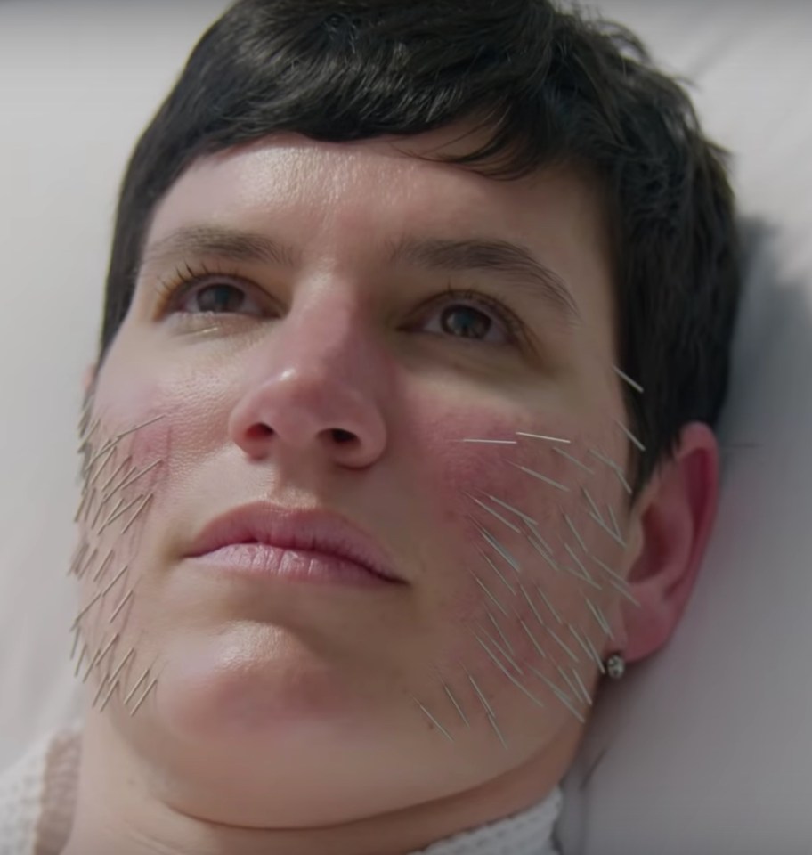 The Goop Lab preview also features a woman with acupuncture pins covering her face