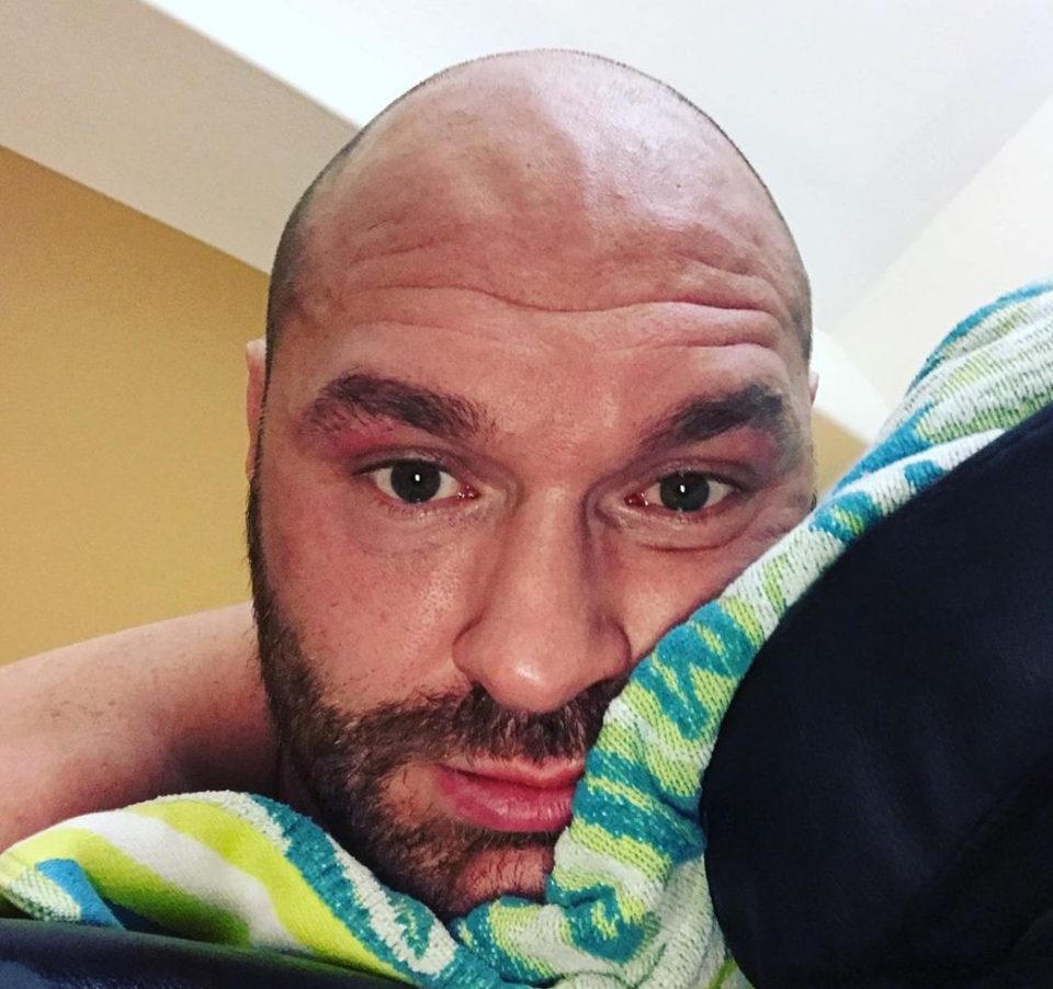  Tyson Fury has admitted he is masturbating seven times a day to release testosterone ahead of his rematch against Wilder