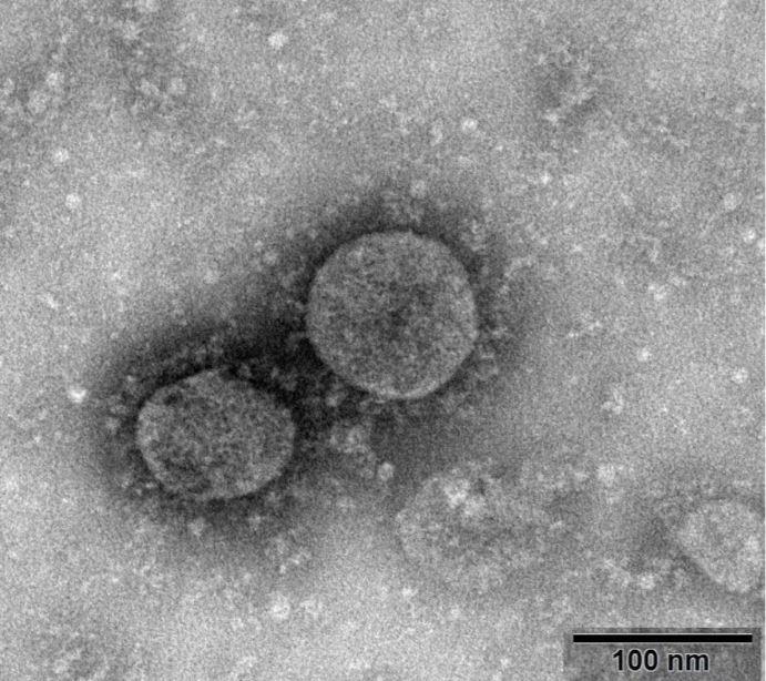  The first image of the coronavirus was shared by China's National Microbiology Data Center and shows particles taken from a patient on January 22.