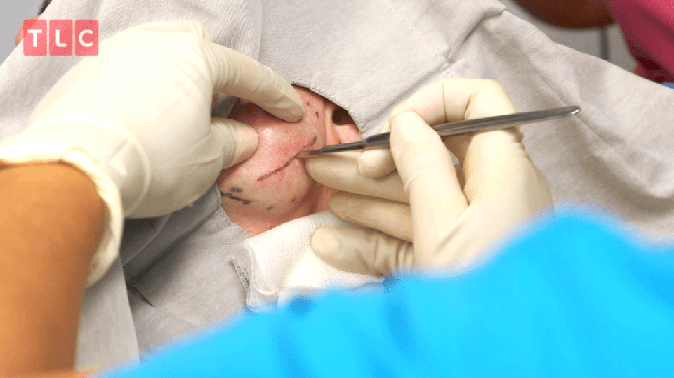  She makes a cut into the lump with a scalpel once the area has been numbed