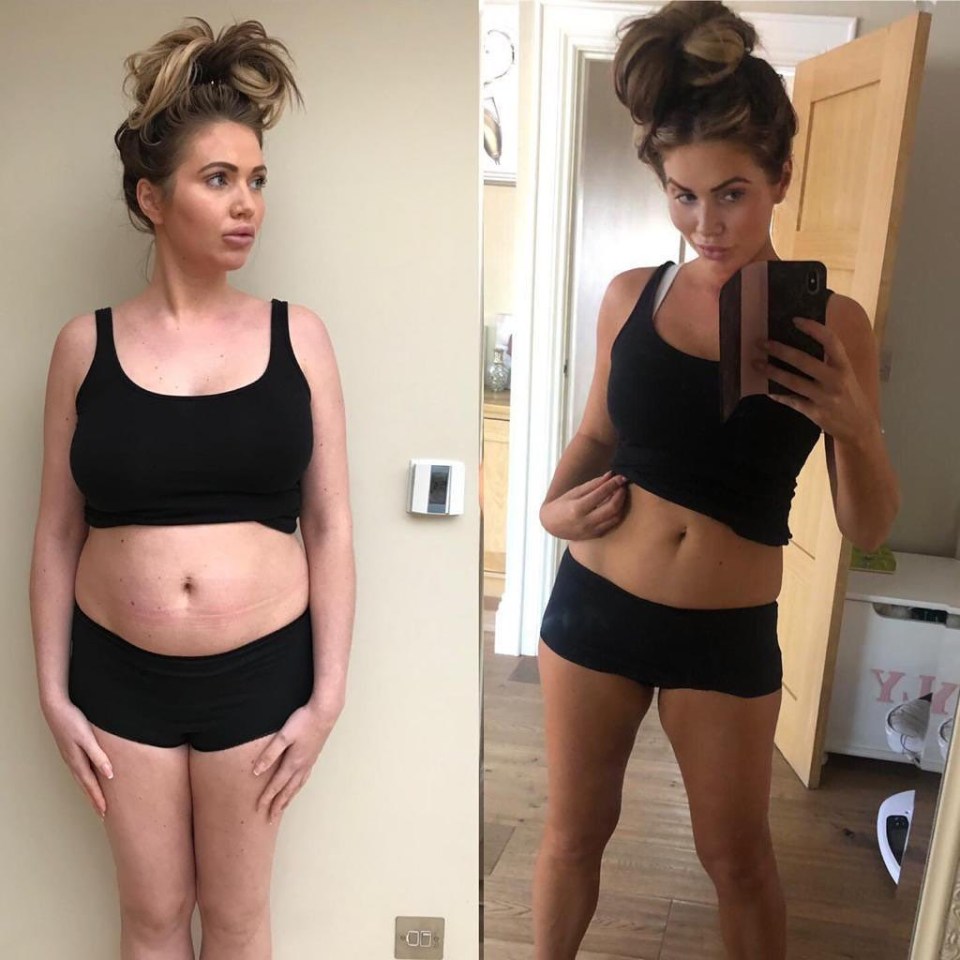 Amy put on two stone after giving birth to her second child