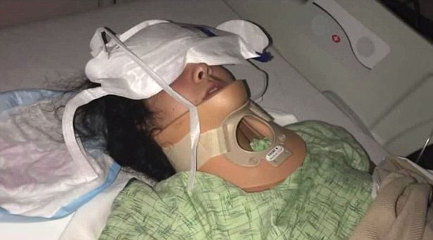  Anna Worden, 18, suffered a skull fracture and bleeding on the brain after she fell and hit her head while attempting the Kiki challenge, where you jump out of a car door