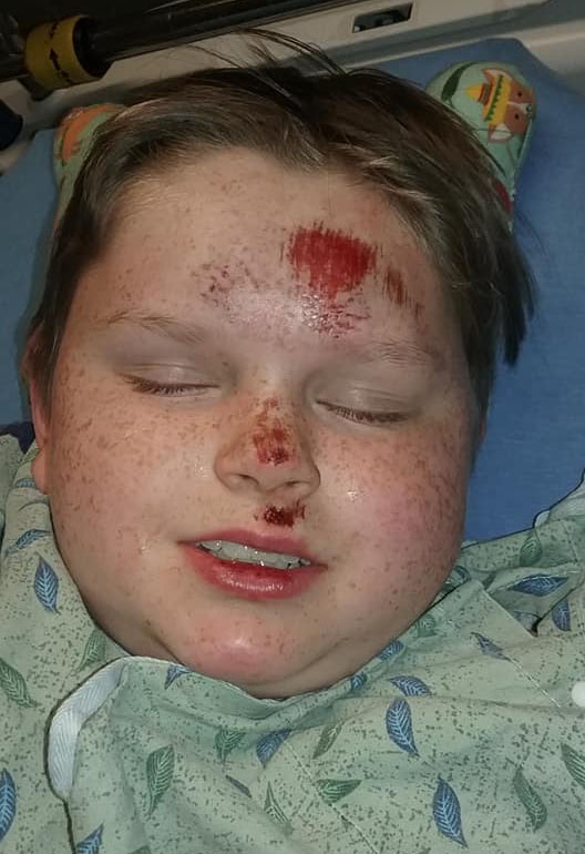  The boy was pictured with a bloodied face in hospital