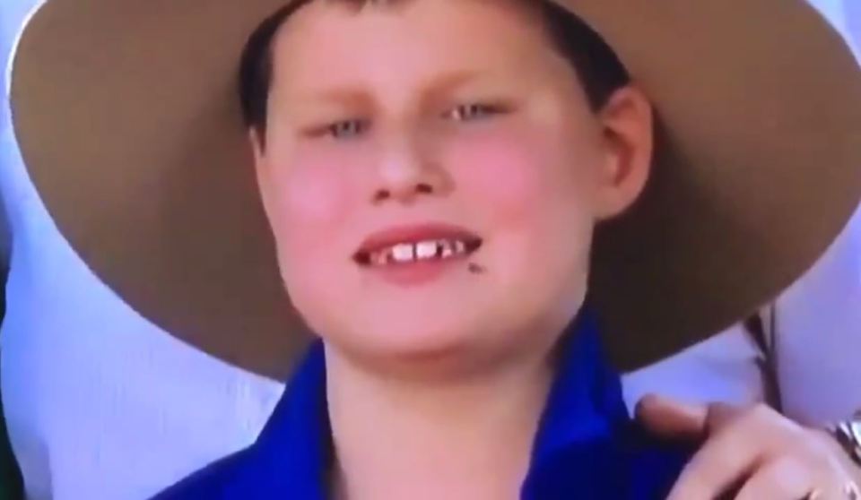  While he smiled at the camera, one of several flies starts crawling towards his mouth