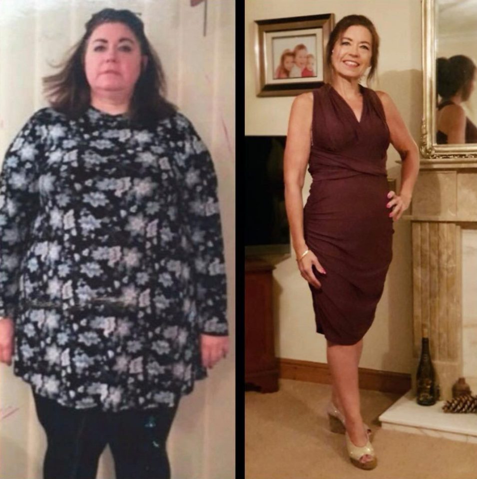  Yvonne put on weight after giving up exercise and developing an unhealthy addiction to snacking