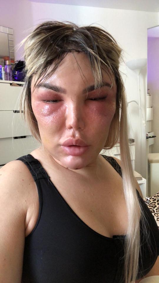  Jessica still has more surgery booked in, including bum implants and another nose job