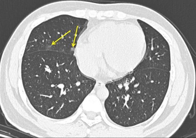  CT scans show the inner organs in a three-dimensional way