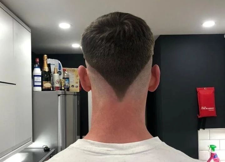 22-year-old Tommy’s cut makes it appear as if he has racing stripes, but whoever did it has clearly taken time to ensure that it is perfectly symmetrical.