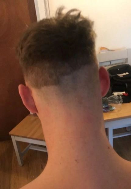 Matt, 20,  tried to do a skin fade and then realised how hard difficult it is to get right