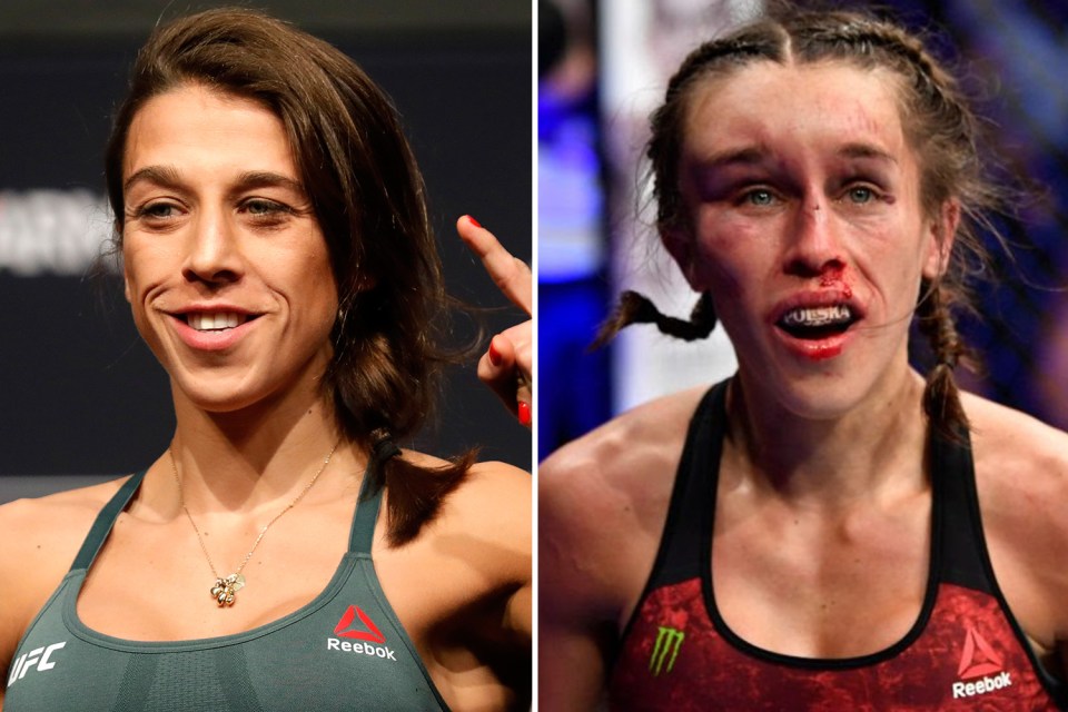  Joanna Jedrzejczyk looked barely recognisable after her thrilling fight with Weili Zhang